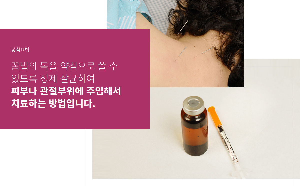 봉침요법